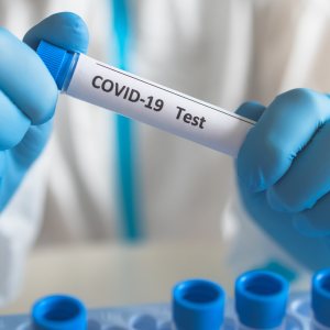Covid-19 Testing in Bakersfield, CA
